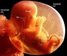 Foetus
